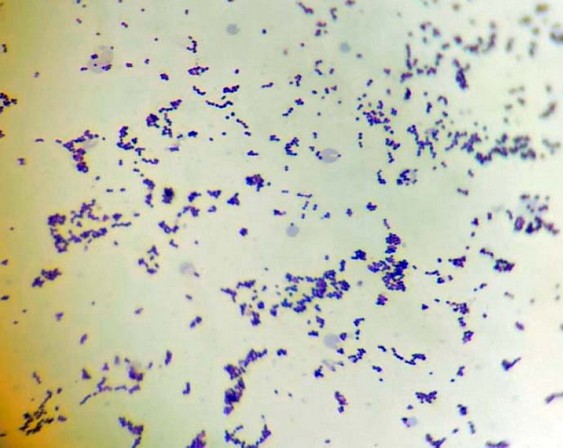 diplococcus pneumoniae